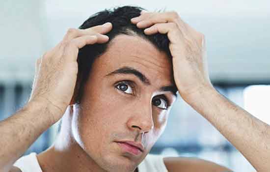 champús para la perdida de cabello en hombres